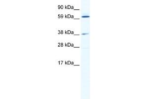 WB Suggested Anti-ALX3 Antibody Titration:  2. (ALX3 antibody  (N-Term))