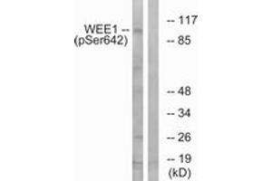 Western blot analysis of extracts from 293 cells treated with etoposide 25uM 60', using WEE1 (Phospho-Ser642) Antibody.