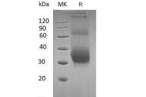 NKG2D Ligand 1-Like (LOC100738183) protein (His tag)