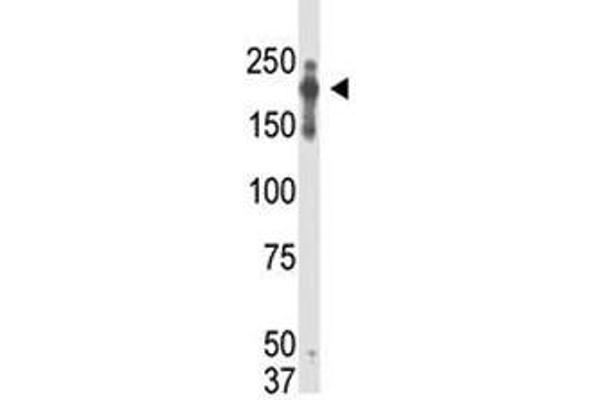 PRDM2 antibody  (AA 1-347)