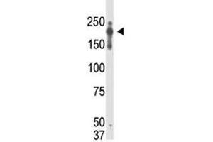 Western blot analysis of PRDM2 / RIZ1 antibody and transfected cell lysate (PRDM2 antibody  (AA 1-347))