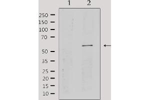 Western blot analysis of extracts from HepG2, using Cytochrome P450 2A13 Antibody. (CYP2A13 antibody)