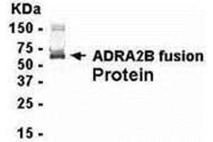 Western Blotting (WB) image for anti-Adrenergic, alpha-2B-, Receptor (ADRA2B) (AA 200-299) antibody (ABIN2467937) (ADRA2B antibody  (AA 200-299))