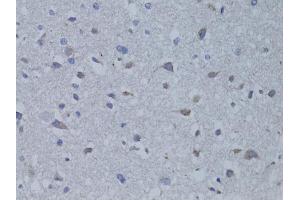 Immunohistochemistry of paraffin-embedded rat brain using BDNF antibody.