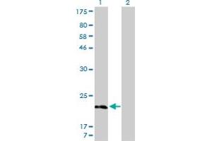 Western Blot analysis of MYL5 expression in transfected 293T cell line by MYL5 monoclonal antibody (M01), clone 1C5. (MYL5 antibody  (AA 1-132))