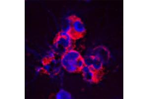 Staining of a cytospin preparation of peripheral blood mononuclear cells (PBMC) isolated from buffycoat. (Cathelicidin antibody)