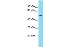 Western Blotting (WB) image for anti-Lysine (K)-Specific Demethylase 4E (KDM4E) (N-Term) antibody (ABIN2791605)