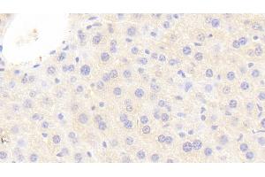 #VALUE! (SAA antibody  (AA 20-122))