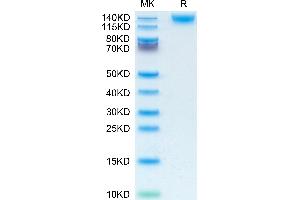 CD45 Protein (AA 26-577) (His tag)