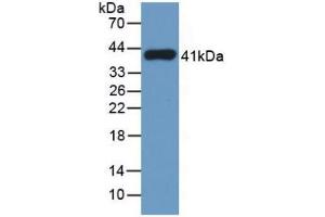 Figure. (TPSAB1 antibody  (AA 161-262))