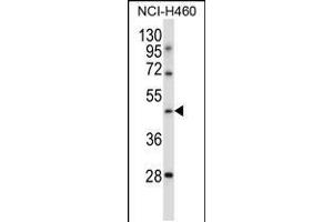 Western blot analysis in NCI-H460 cell line lysates (35ug/lane). (TLE6 antibody  (N-Term))