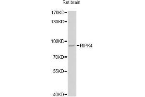 Western blot analysis of extracts of rat brain, using RIPK4 antibody. (RIPK4 antibody)