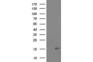 Western Blotting (WB) image for anti-NADH Dehydrogenase (Ubiquinone) 1 alpha Subcomplex, 7, 14.5kDa (NDUFA7) antibody (ABIN1499662)