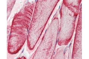 Immunohistochemical analysis of paraffin-embedded human skeletal muscle tissues using CRYAB mouse mAb. (CRYAB antibody  (AA 1-175))