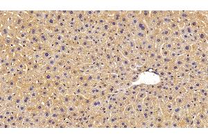 Detection of MASP1 in Mouse Liver Tissue using Polyclonal Antibody to Mannose Associated Serine Protease 1 (MASP1) (MASP1 antibody  (AA 25-453))
