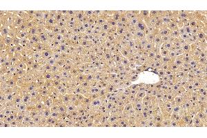 Detection of MASP1 in Mouse Liver Tissue using Polyclonal Antibody to Mannose Associated Serine Protease 1 (MASP1) (MASP1 antibody  (AA 25-453))