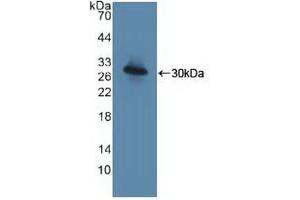 Western blot analysis of recombinant Human TICAM1. (TICAM1 antibody  (AA 443-685))