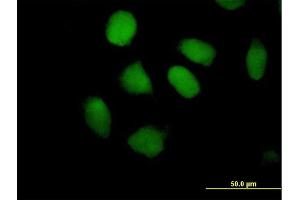 Immunofluorescence of purified MaxPab antibody to ZNF547 on HeLa cell. (ZNF547 antibody  (AA 1-402))
