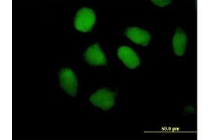 Immunofluorescence of purified MaxPab antibody to ZNF547 on HeLa cell.