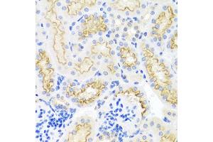 Immunohistochemistry of paraffin-embedded mouse kidney using SRPX antibody at dilution of 1:100 (x40 lens).