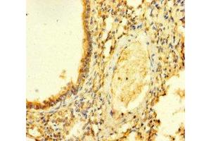 Immunohistochemistry of paraffin-embedded human lung tissue using ABIN7153265 at dilution of 1:100