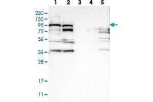 Western blot analysis of Lane 1: RT-4, Lane 2: U-251 MG, Lane 3: Human Plasma, Lane 4: Liver, Lane 5: Tonsil with RRP1B polyclonal antibody  at 1:250-1:500 dilution. (RRP1B antibody)