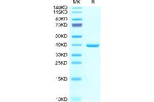 Epiregulin Protein (EREG) (AA 56-101) (Fc Tag)