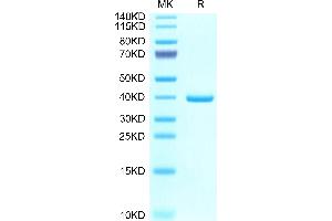 Mouse EREG on Tris-Bis PAGE under reduced condition. (Epiregulin Protein (EREG) (AA 56-101) (Fc Tag))