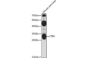 Western blot analysis of extracts of mouse pancreas, using CTRC antibody (ABIN7266396) at 1:1000 dilution. (Elastase 4 antibody  (AA 30-150))