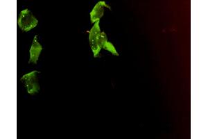 Immunofluorescence of monoclonal antibody to SMN2 on HeLa cell. (SMN2 antibody  (AA 1-282))