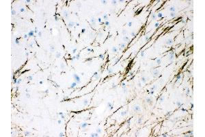 Anti- TH Picoband antibody,IHC(P) IHC(P): Mouse Brain Tissue (TH antibody  (Middle Region))