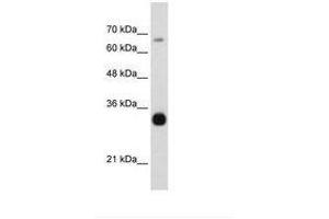 Image no. 3 for anti-THO Complex 3 (THOC3) (AA 151-200) antibody (ABIN203067) (THO Complex 3 antibody  (AA 151-200))