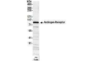 Western Blotting (WB) image for anti-Androgen Receptor (AR) (AA 1-50) antibody (ABIN7454995)
