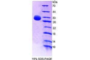 SDS-PAGE analysis of Rat SHP Protein.