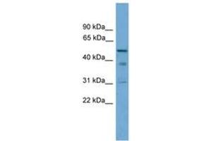Image no. 1 for anti-Tubulointerstitial Nephritis Antigen (TINAG) (AA 251-300) antibody (ABIN6745079) (TINAG antibody  (AA 251-300))