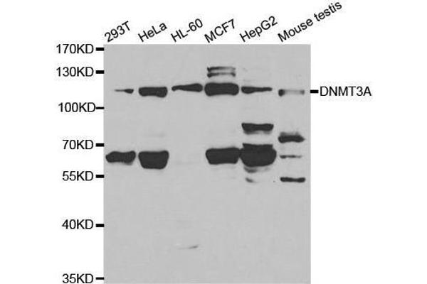 DNMT3A 抗体  (AA 500-700)