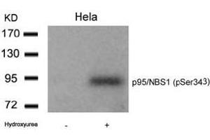Image no. 1 for anti-Nibrin (NBN) (pSer343) antibody (ABIN196714)