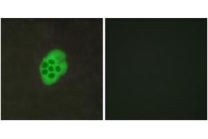 Immunofluorescence analysis of MCF7 cells, using HTR4 Antibody. (Serotonin Receptor 4 antibody  (AA 141-190))