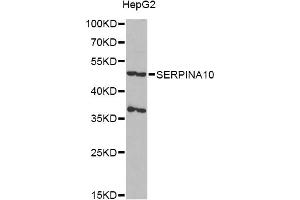 Western blot analysis of extracts of HepG2 cells, using SERPINA10 antibody (ABIN6292722) at 1:1000 dilution.