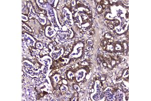 IHC analysis of GDA using anti-GDA antibody . (GDA antibody  (AA 220-446))