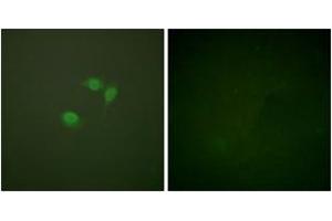 Immunofluorescence analysis of NIH-3T3 cells, using Sumo1 Antibody. (SUMO1 antibody  (AA 1-50))