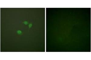 Immunofluorescence (IF) image for anti-Small Ubiquitin Related Modifier Protein 1 (SUMO1) (AA 1-50) antibody (ABIN1533443)