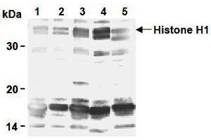 Western Blotting (WB) image for anti-H1 Histone Family, Member 0 (H1F0) antibody (ABIN1449237)