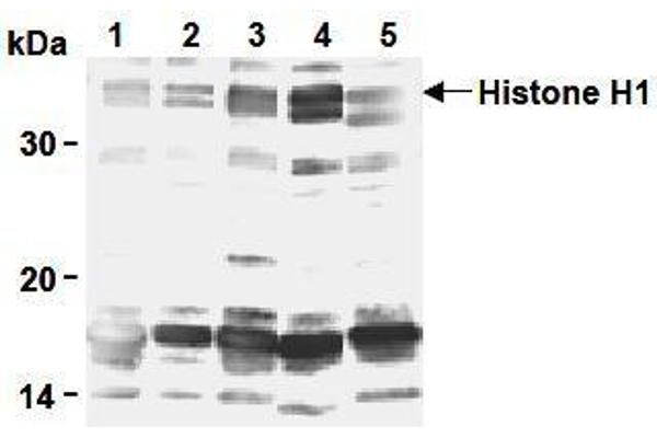 Histone H1 anticorps
