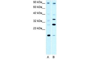 WB Suggested Anti-PARP11  Antibody Titration: 0. (PARP11 antibody  (N-Term))