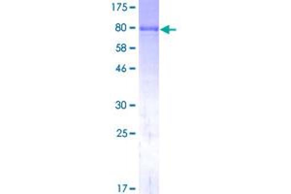 ALPL Protein (AA 1-524) (GST tag)