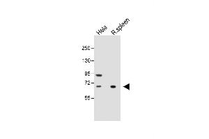 All lanes : Anti-ALOX12 Antibody (C-term) at 1:1000 dilution Lane 1: Hela whole cell lysate Lane 2: Rat spleen whole tissue lysate Lysates/proteins at 20 μg per lane. (ALOX12 antibody  (C-Term))