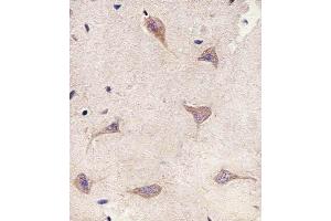 Immunohistochemical analysis of paraffin-embedded H. (Tuberin antibody  (AA 1397-1426))