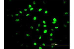 Immunofluorescence of monoclonal antibody to ZNF24 on HeLa cell. (ZNF24 antibody  (AA 1-368))