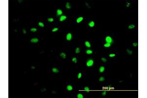 Immunofluorescence of monoclonal antibody to ZNF24 on HeLa cell. (ZNF24 antibody  (AA 1-368))